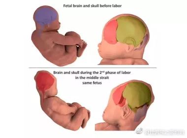 ���������輹������