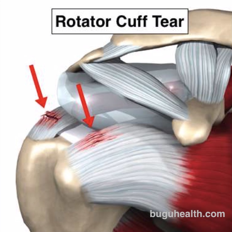 �����˶�����ҽ������