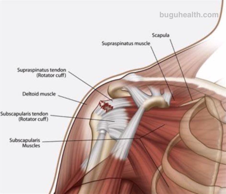 �����˶�����ҽ������