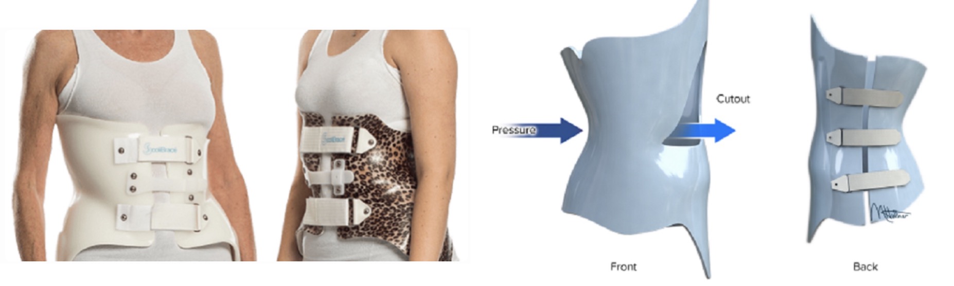 ��������֮��