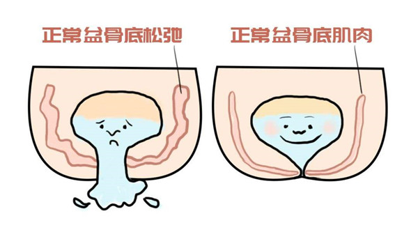 ��ʧ������׼�����������������ָ��������ǿ���