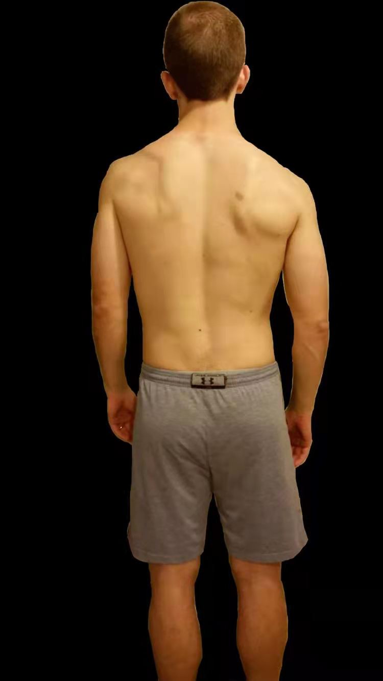 ���ǿ���