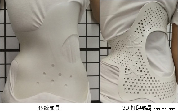 ֧�� ��3D��ӡ