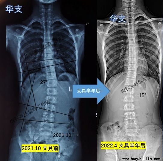 ��������,������������,���ǿ���