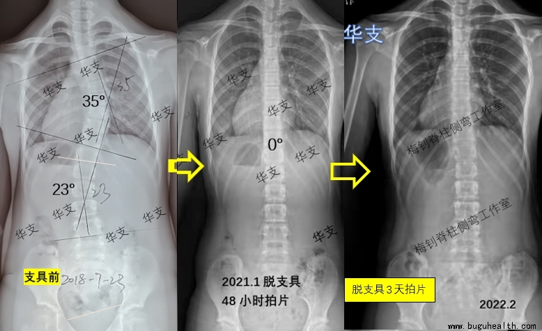 ��������,������������,���ǿ���