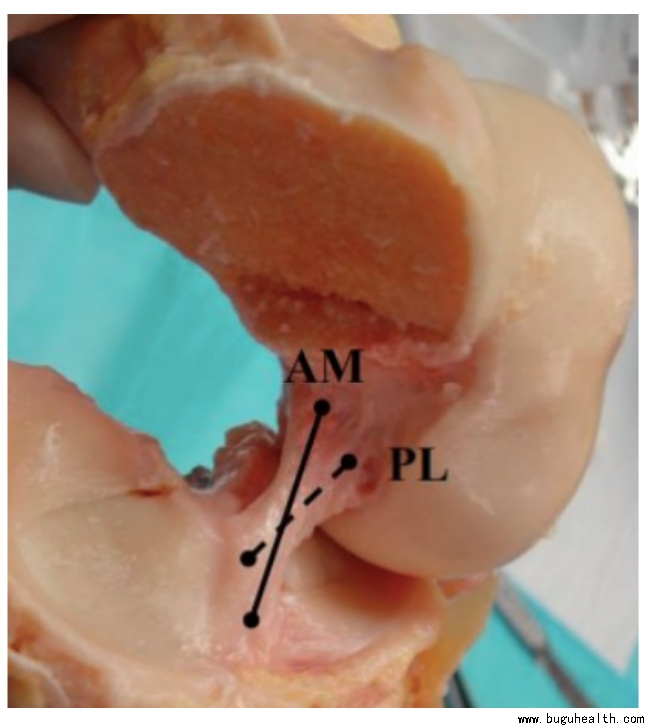 布骨医学科普、肌骨康复、布骨康复 布骨医学科普、肌骨康复、布骨康复
