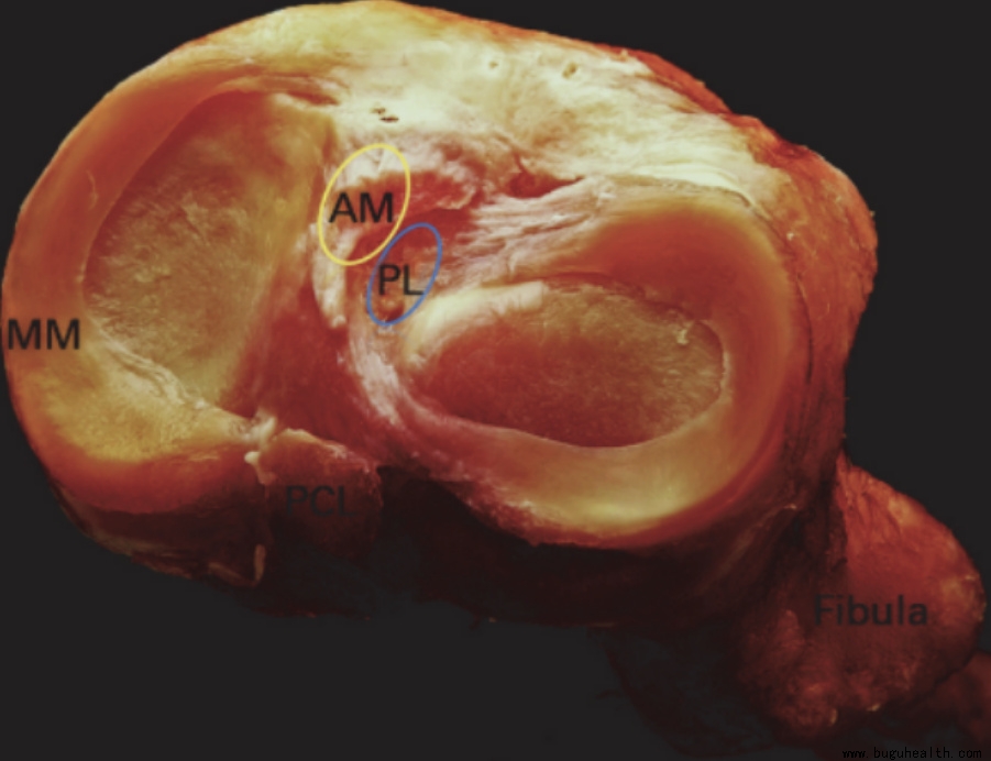 布骨医学科普、前交叉韧带、布骨康复 布骨医学科普、前交叉韧带、布骨康复