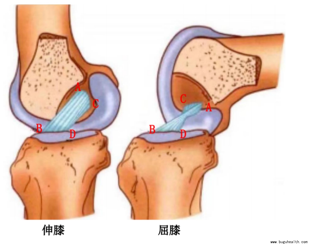 布骨医学科普、前交叉韧带重建术后、布骨康复 布骨医学科普、前交叉韧带重建术后、布骨康复