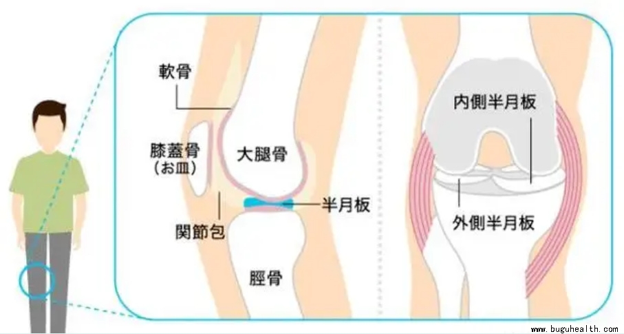 布骨医学科普、半月板术后、布骨康复 布骨医学科普、半月板术后、布骨康复