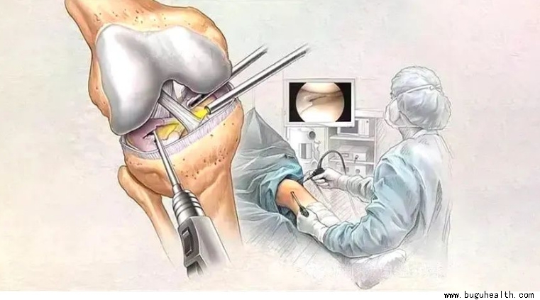 布骨医学科普、肌骨康复、布骨康复 布骨医学科普、肌骨康复、布骨康复