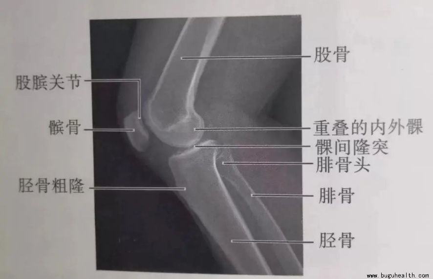 ����ҽѧ���ա����ǿ��������ǿ�����ϥ�ؽ�����