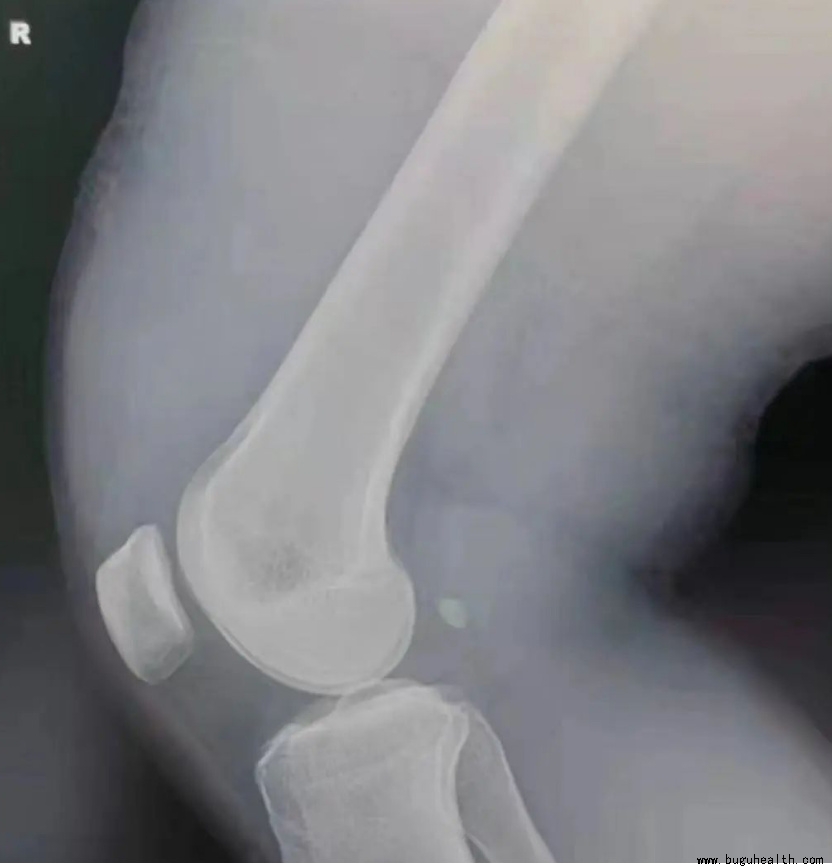 ����ҽѧ���ա����ǿ��������ǿ���