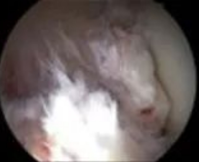 ǰ����������